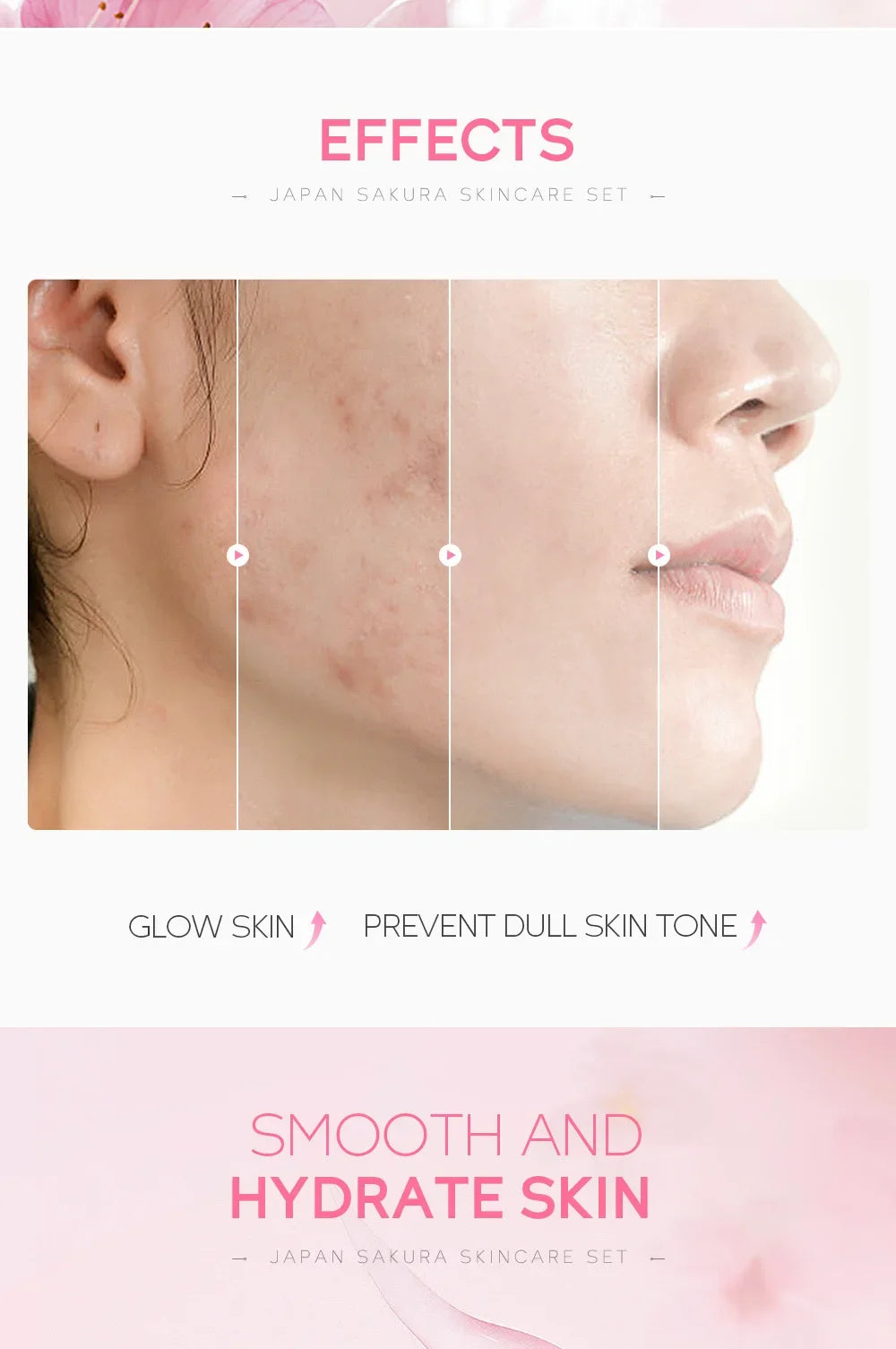 Комплект за грижа за кожата LAIKOU Sakura, хидратиращ и намаляващ фините линии, почистващ продукт за пори, 5 части