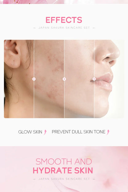 Комплект за грижа за кожата LAIKOU Sakura, хидратиращ и намаляващ фините линии, почистващ продукт за пори, 5 части